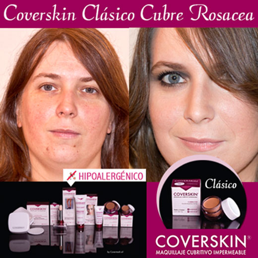 Coverskin Rosacea