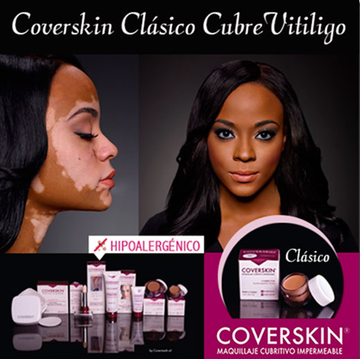 Coverskin Vitiligo