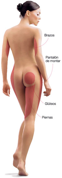 CAVIX