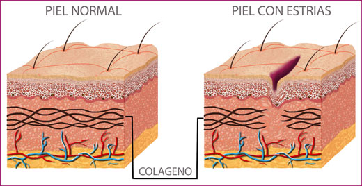 ESTRIAS - COLAGENO