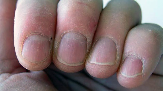 Uñas y piel: cómo se relacionan y se protegen juntas