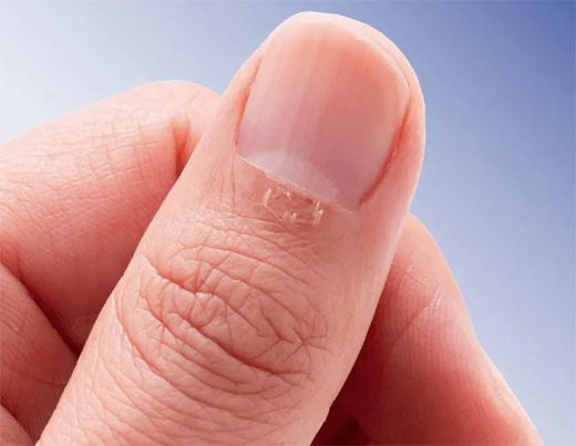 Uñas y piel: cómo se relacionan y se protegen juntas