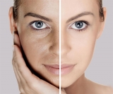 Afipore Cream reduce poros dilatados