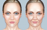 As alteraes faciais que ocorrem com a idade